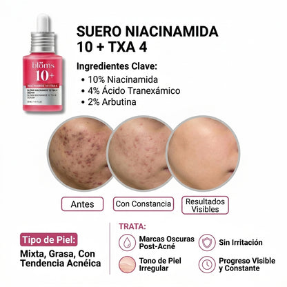 Suero Cero Huella — "Tu cara no tiene por qué contar cada grano que tuviste."